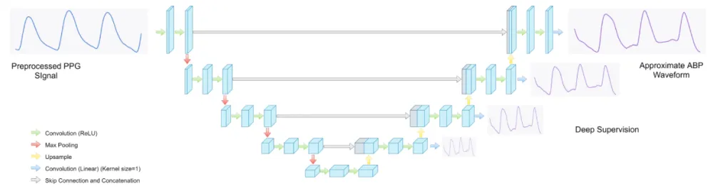 Edge AI pipeline on embedded hardware
